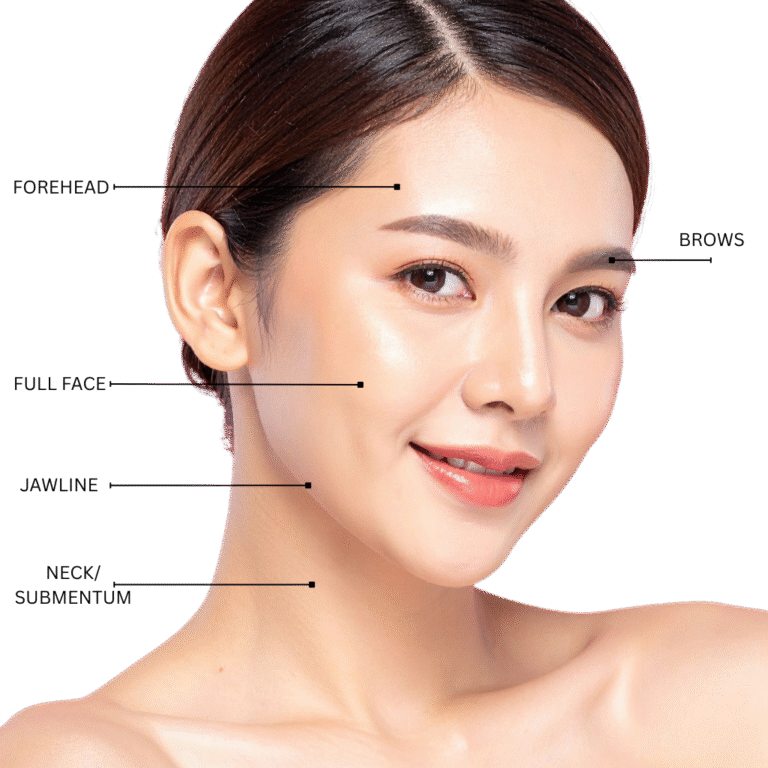 EMFACE TREATMENT AREAS