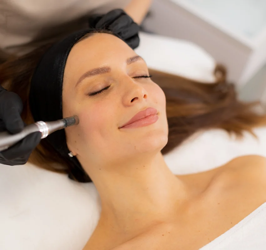 Morpheus8 Microneedling