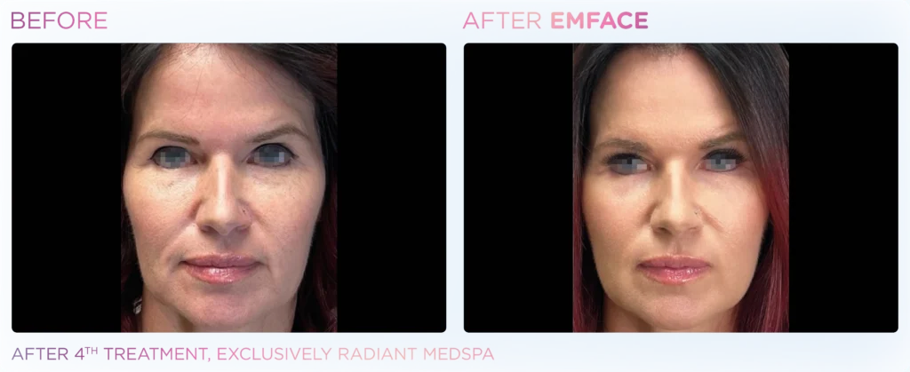 Emface_PIC_Ba-card-female-face-061_ENUS100
