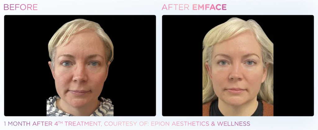 Emface_PIC_Ba-card-female-face-092_ENUS100