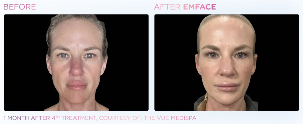Emface_PIC_Ba-card-female-face-097_ENUS100