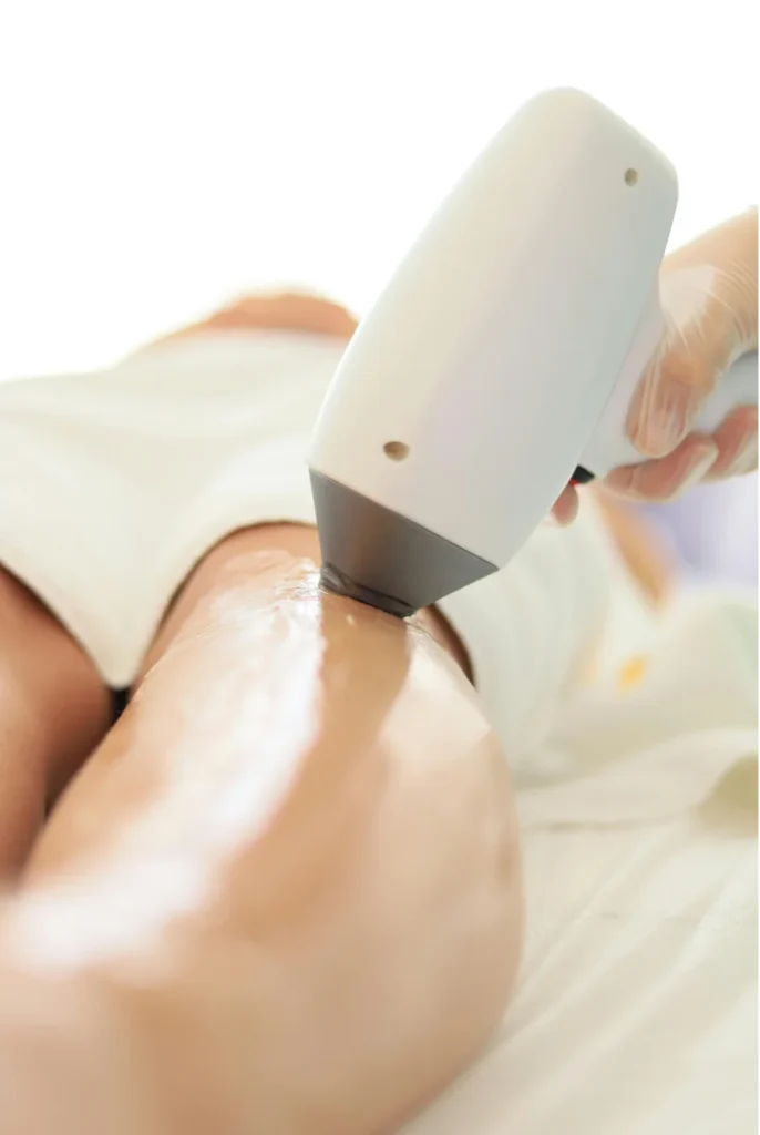 Benefits of Laser Hair Removal